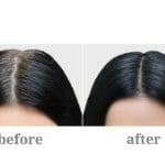 Emu oil for hair loss reviews